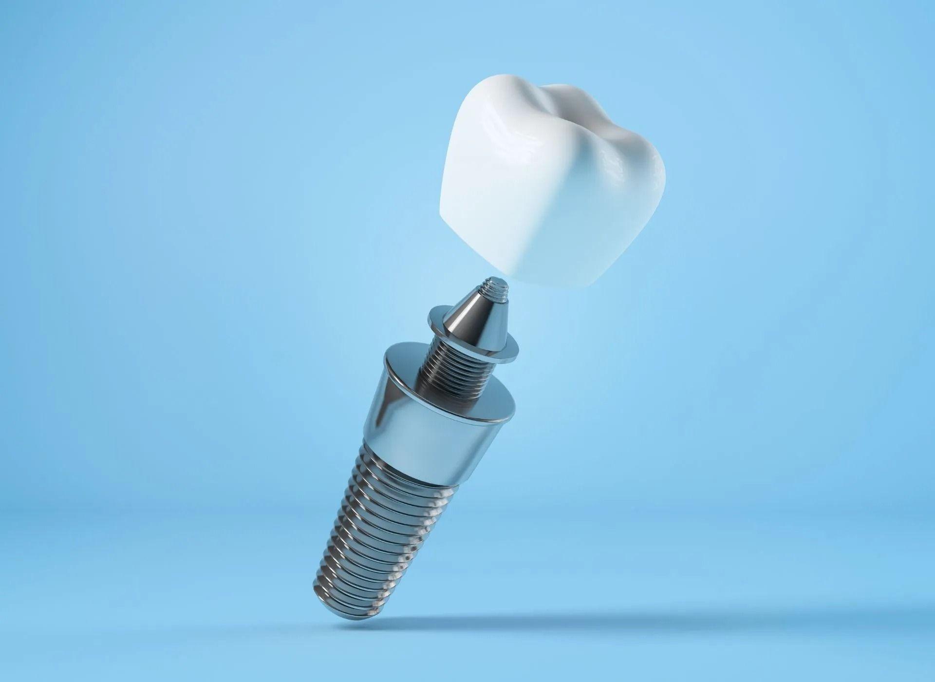 Woo Dental | Dr. Benjamin Woo And Associates